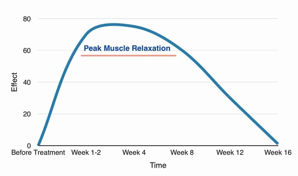 Peak muscle relaxation with botox