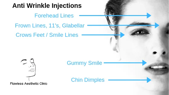Anti wrinkle aesthetic treatments Anti wrinkle aesthetic treatments