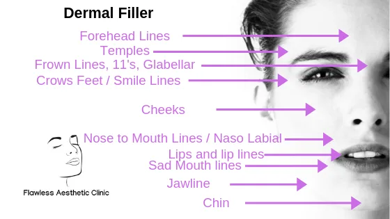 dermal filler aesthetic treatments dermal filler aesthetic treatments