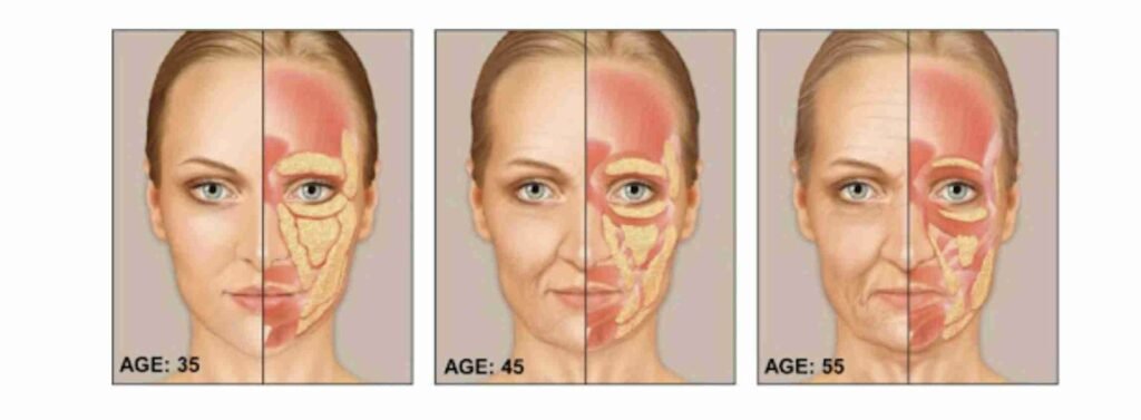 facial ageing Muscle and fat diagram