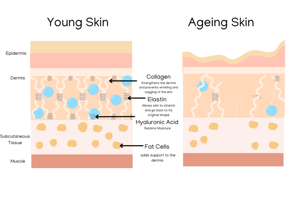 Collagen Loss